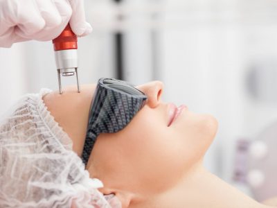 เลเซอร์รักษาริ้วรอยและแผลหลุม SEMI-ABLATIVE LASER RESURFACING ERBIUM:YAG LASER