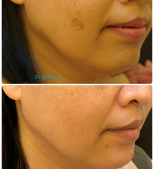 127223927_3702933579752297_8327893796870738266_n