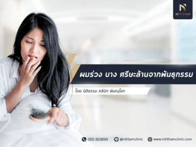 ผมร่วง บาง ศรีษะล้านจากพันธุกรรม