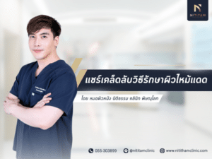 แชร์เคล็ดลับวิธีรักษาผิวไหม้แดด โดยหมอผิวหนัง