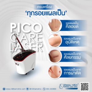 PicoCare เลเซอร์หลุมสิว
