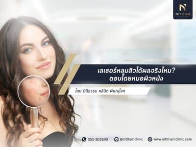 เลเซอร์หลุมสิวได้ผลจริงไหม? ตอบโดยหมอผิวหนัง นิติธรรมคลินิก