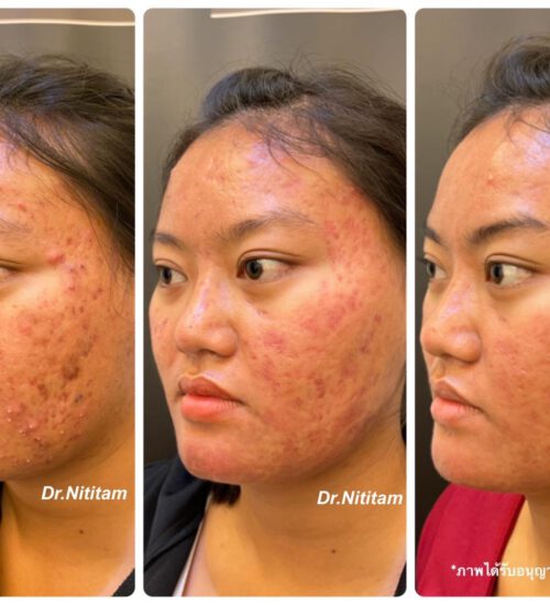 AD8BF751-509D-47C9-ACB4-EBE65300F68A