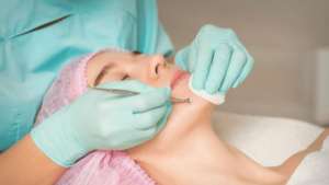 How to properly treat acne