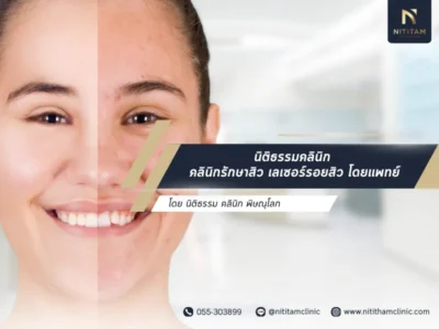 คลินิกรักษาสิว กรุงเทพ