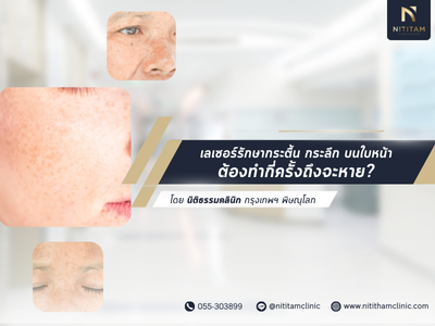 เลเซอร์รักษากระตื้น กระลึก บนใบหน้า ต้องทำกี่ครั้งถึงจะหาย?