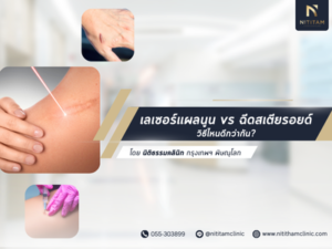 เปรียบเทียบเลเซอร์แผลนูน กับ ฉีดสเตียรอยด์