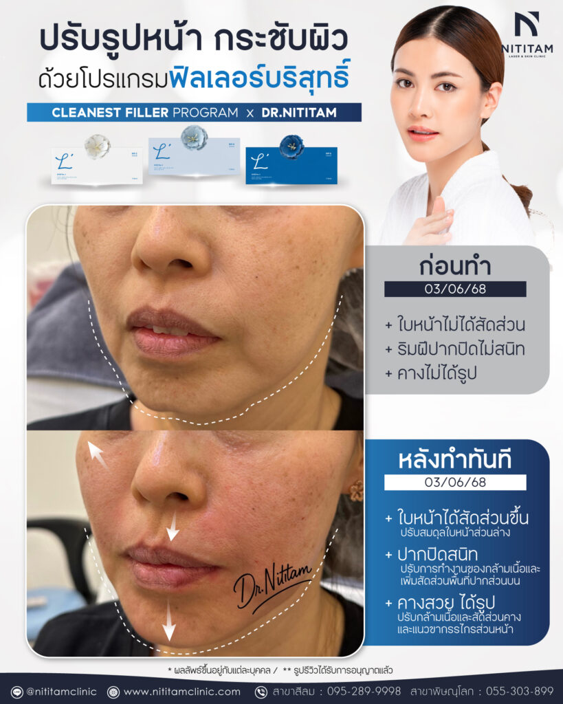 504180680_1068980938434254_6529028975538926837_n