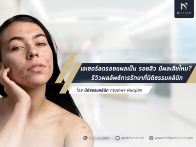 เลเซอร์ลดรอยแผลเป็น รอยสิว มีผลเสียไหม? รีวิวผลลัพธ์การรักษาที่นิติธรรมคลินิก