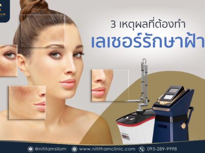 เลเซอร์รักษาฝ้า
