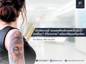 tattoo-removal-aftercare-tips