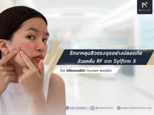 รักษาหลุมสิวตรงจุดอย่างปลอดภัย ด้วยคลื่น RF จาก Sylfirm X