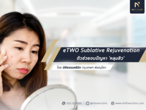 เจาะลึก eTWO Sublative Rejuvenation ตัวช่วยจบปัญหา 'หลุมสิว' ที่หลายคนตามหา!