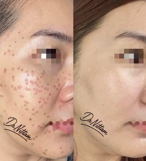 948D5356-6B09-4EC5-BE7B-B68B6D798F42