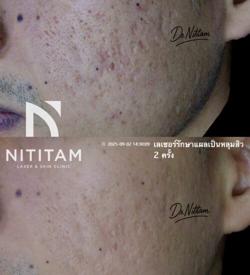 A6FDB2B0-3822-4E8F-BDD5-945F0FCEC521