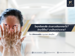 ด่างขาว เกิดจากอะไร