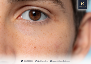 ค่าใช้จ่ายของ Pico Toning