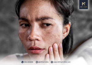 Pico Toning ช่วยรักษาฝ้าได้จริงไหม