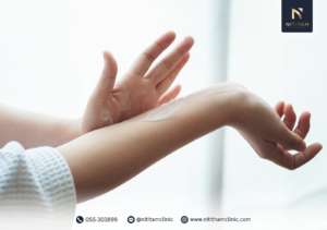 วิธีป้องกันไม่ให้ผื่นลุกลาม