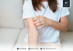 สาเหตุที่ทำให้อาการโรคผื่นภูมิแพ้ผิวหนังกำเริบ