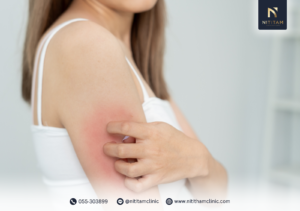 เข้าใจโรคผื่นภูมิแพ้ผิวหนังให้ลึกขึ้น