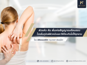 สัญญาณเตือนของ "โรคผื่นภูมิแพ้ผิวหนัง"