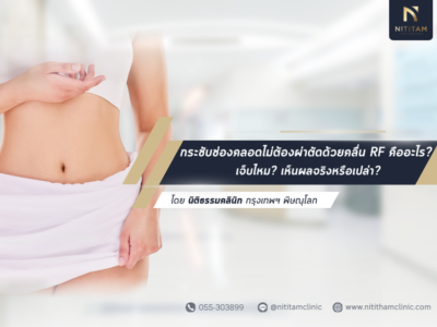 กระชับช่องคลอดไม่ต้องผ่าตัด ด้วยคลื่น RF คืออะไร? เจ็บไหม? เห็นผลจริงหรือเปล่า? คำถามที่อยากรู้ก่อนตัดสินใจทำ!