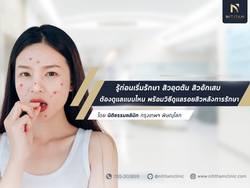 รู้ก่อนเริ่มรักษา สิวอุดตัน สิวอักเสบ ต้องดูแลแบบไหน พร้อมวิธีดูแลรอยสิวหลังการรักษา