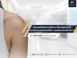 เมื่อแผลเป็นรักษาหายไม่หาย เป็นรอยนูนเด่นชัด เลเซอร์รักษาแผลเป็นช่วยได้ไหม? แผลเป็นแบบไหนที่ทำได้บ้าง?