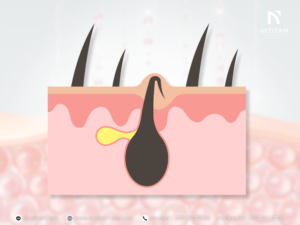 ชั้นขนคุด