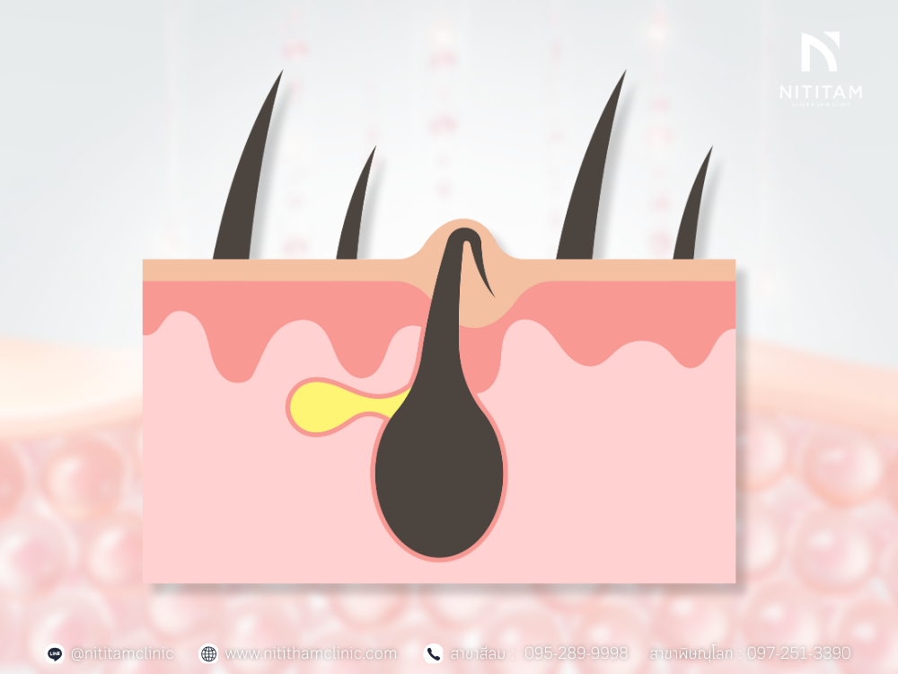 ชั้นขนคุด