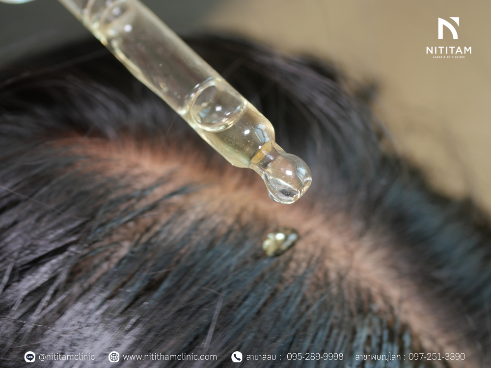 บำรุงรากผมด้วยวิตามินเข้มข้น