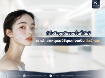 รักษาสิว สิวอุดตัน สิวอักเสบ