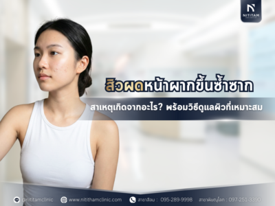 สิวผดหน้าผากขึ้นซ้ำซาก สาเหตุเกิดจากอะไร? พร้อมวิธีดูแลผิวที่เหมาะสม