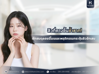 สิวที่คางขึ้นซ้ำซาก! เช็กสมดุลฮอร์โมนและพฤติกรรมกระตุ้นสิวอักเสบ