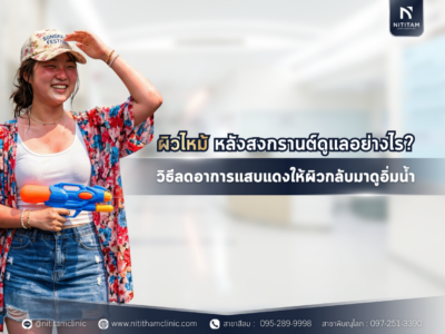 ผิวไหม้หลังสงกรานต์ดูแลอย่างไร? วิธีลดอาการแสบแดงให้ผิวกลับมาดูอิ่มน้ำ