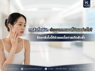 กดสิวที่คลินิก ต่างจากกดเองที่บ้านอย่างไร? ทำไมหมอถึงบอกว่าอย่ากดเอง