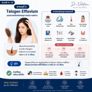 สาเหตุของผมร่วง ผมบาง