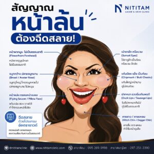 หน้าล้นหลังฉีดฟิลเลอร์ แก้บังไง? ฉีดสลายฟิลเลอร์