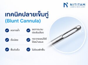 แพทย์เลือกใช้ปลายเข็มทู่ (Blunt Cannula) ซึ่งช่วยลดการช้ำ ลดการบวม ลดการบาดเจ็บต่อหลอดเลือด ลดความเจ็บ กระจายเอนไซม์ได้สม่ำเสมอ