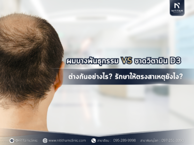 ผมบางพันธุกรรม VS ขาดวิตามิน D3 ต่างกันอย่างไร? รักษาให้ตรงสาเหตุยังไง?