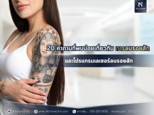 20 คำถามที่พบบ่อยเกี่ยวกับการลบรอยสัก และโปรแกรมเลเซอร์ลบรอยสัก