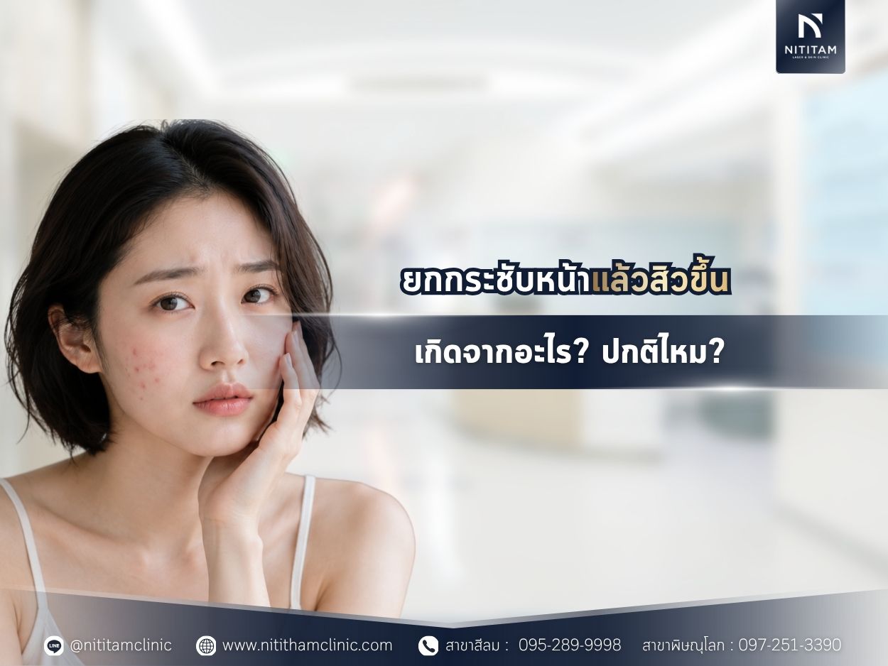 ยกกระชับหน้าแล้วสิวขึ้น เกิดจากอะไร? ปกติไหม?