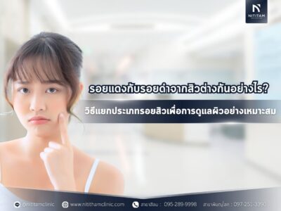 รอยแดงกับรอยดำจากสิวต่างกันอย่างไร? วิธีแยกประเภทรอยสิวเพื่อการดูแลผิวอย่างเหมาะสม