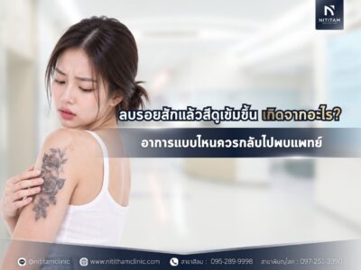 ลบรอยสักแล้วสีดูเข้มขึ้น เกิดจากอะไร? อาการแบบไหนควรกลับไปพบแพทย์