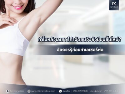 ทำไมหลังเลเซอร์กำจัดขนจึงยังมีขนขึ้นใหม่? ข้อควรรู้ก่อนทำเลเซอร์ต่อ