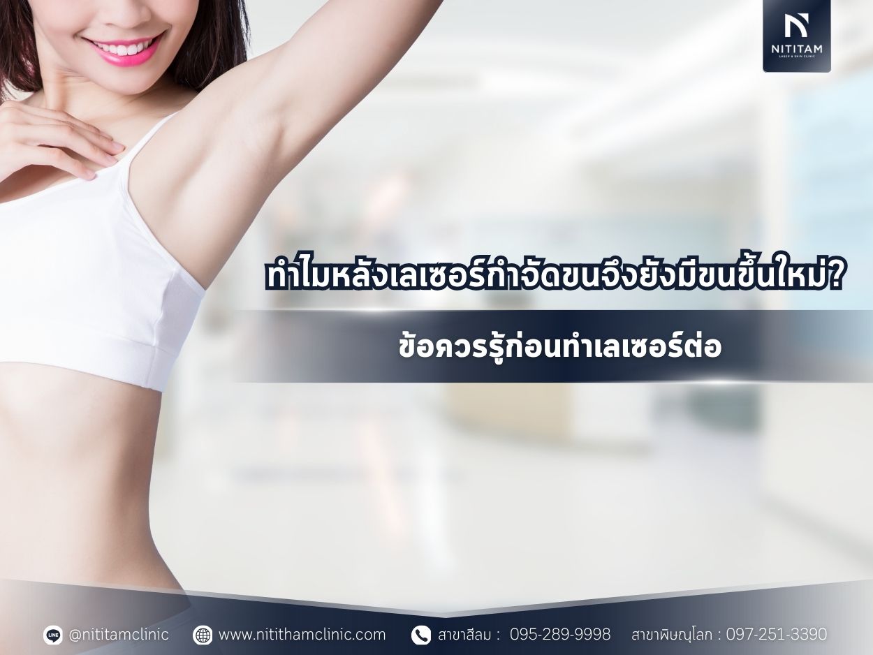 ทำไมหลังเลเซอร์กำจัดขนจึงยังมีขนขึ้นใหม่? ข้อควรรู้ก่อนทำเลเซอร์ต่อ